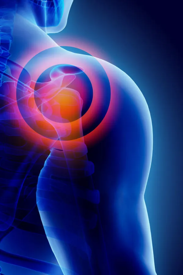 PRP-for-Shoulder-Injury-Treatment A 3D image of a transparent human shoulder, with red radiating circles representing shoulder pain, which can be relieved by PRP treatment for shoulder pain from Dr. David Lans in New Rochelle.