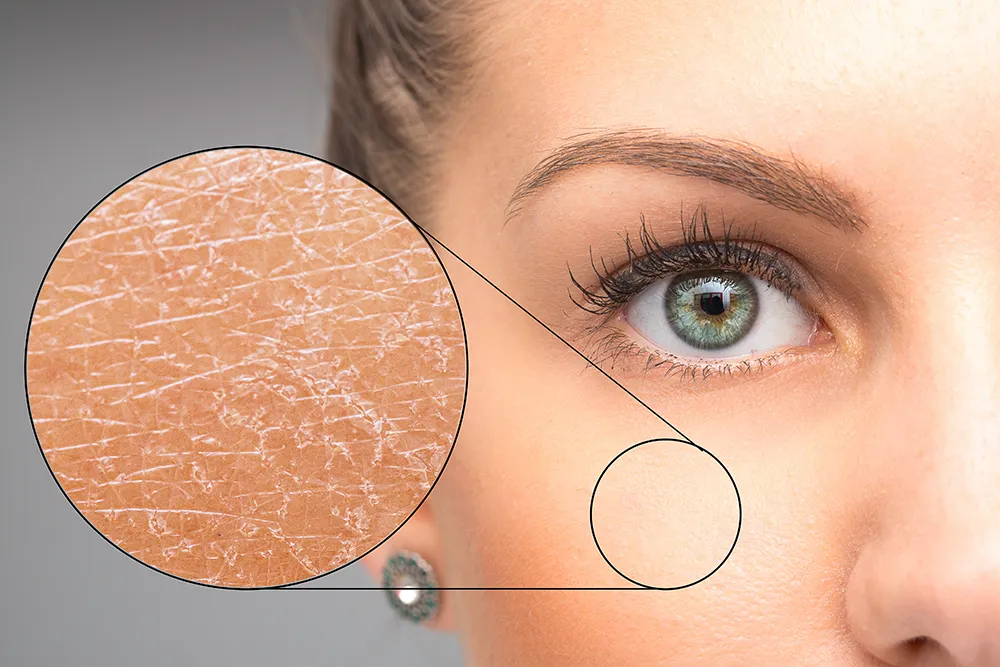 Sjogren's Syndrome Treatment offered by Dr. Lans in New Rochelle New York